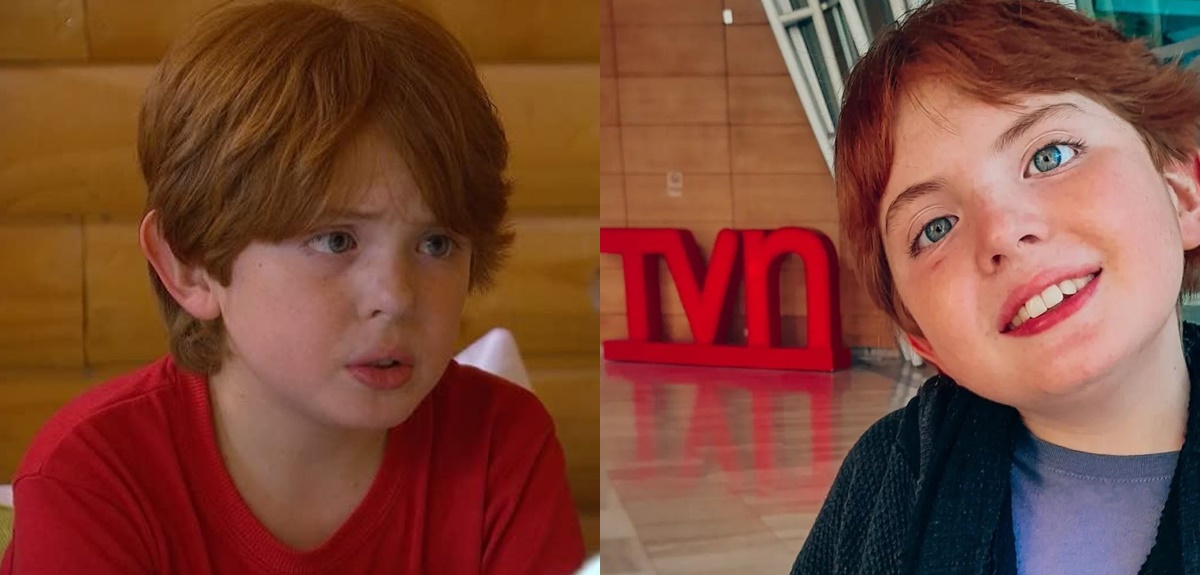 Actor Elías Collado debió someterse por tercera vez a cirugía en su ojo: padece síndrome de Duane