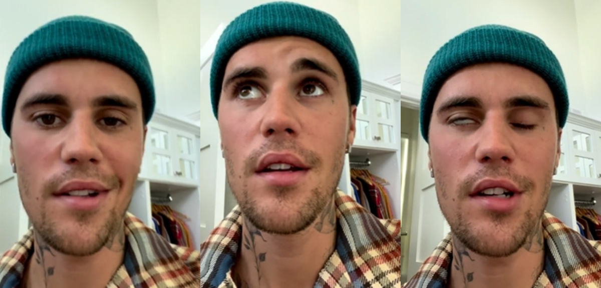 ¿Es grave el Síndrome de Ramsay Hunt? La afección que provocó una parálisis facial a Justin Bieber