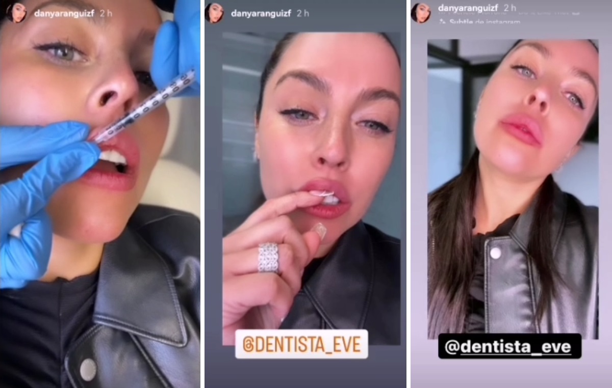 Retoques rostro Daniela Aránguiz