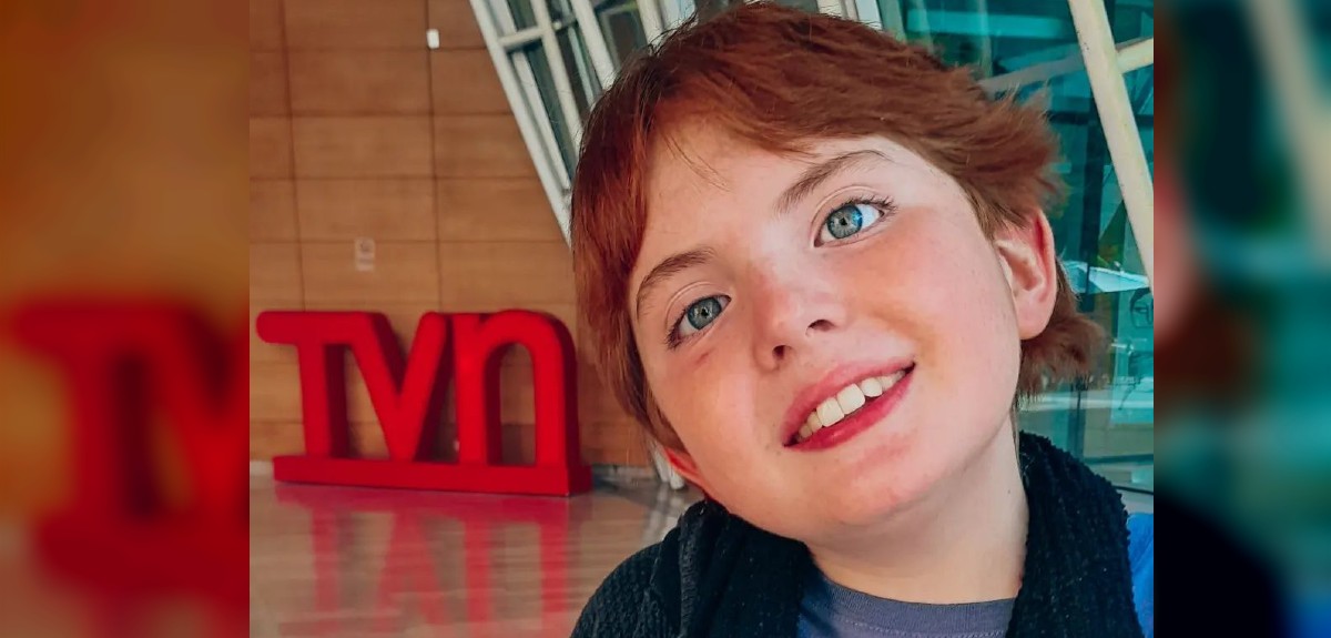 Síndrome de Duane: de qué se trata la afección por la que fue operado el pequeño actor Elías Collado