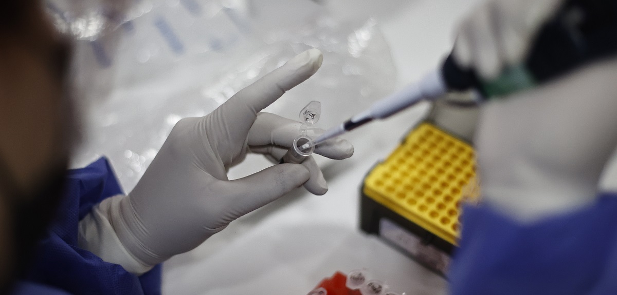 Minsal declara alerta sanitaria por viruela del mono en Chile: ¿en qué consiste la medida?