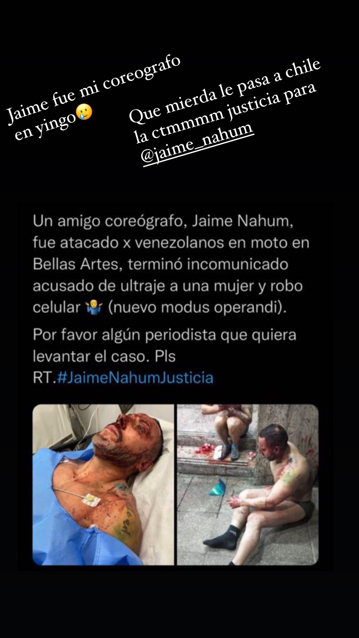 Vale Roth reaccionó a golpiza de coreógrafo