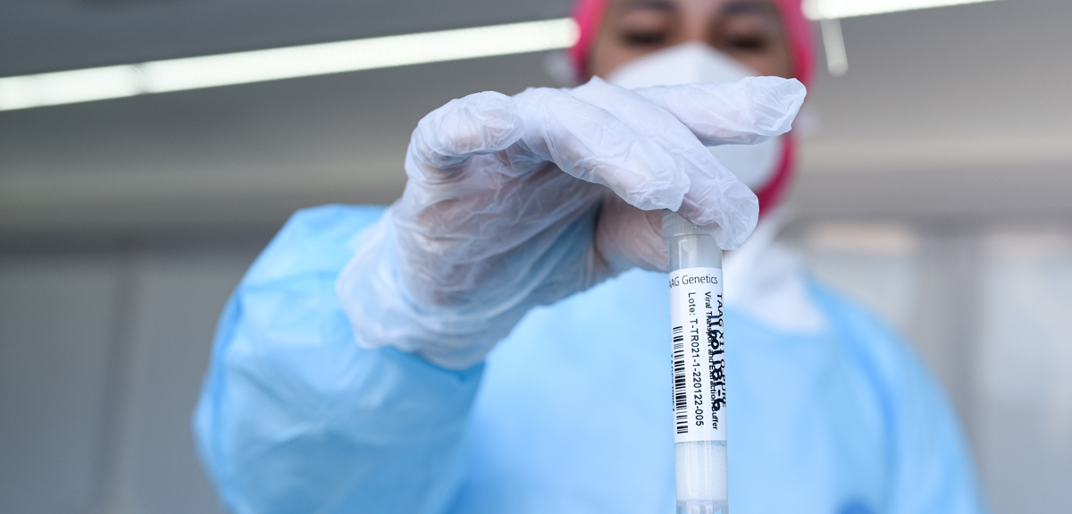 Minsal reportó 8.730 nuevos casos de COVID-19 y 40.928 contagios activos a nivel nacional