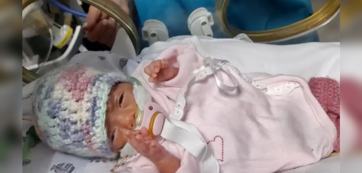 La historia de Olivia, la bebé uruguaya más pequeña de América Latina: pesó apenas 330 gramos