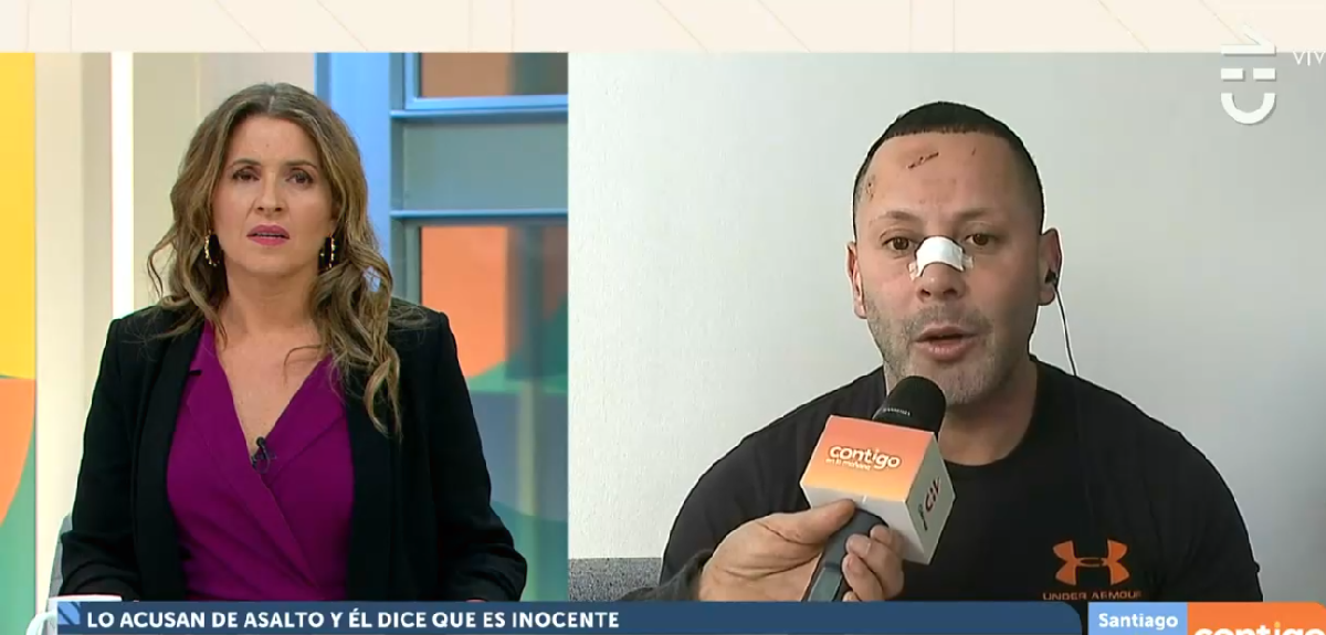 Coreógrafo de TV fue víctima de insólito hecho: fue atacado pero terminó siendo formalizado por robo