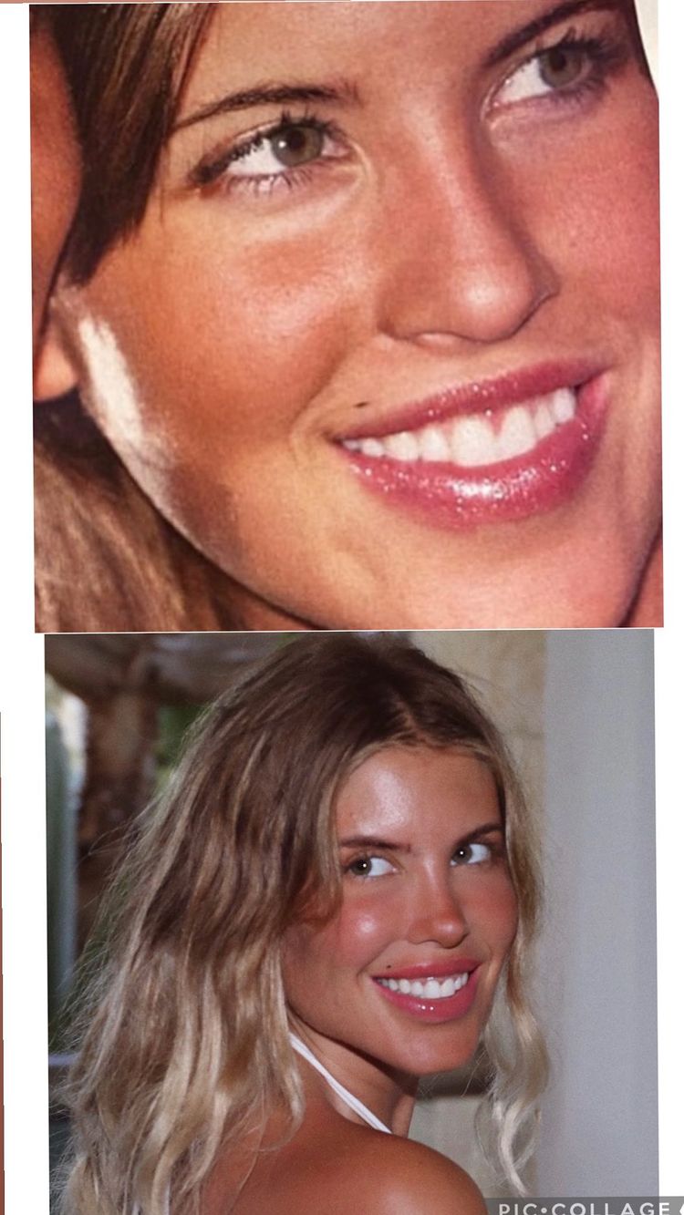 ¿Igual que a loas 17 años? Coté López sorprendió a sus seguidores con bella postal del recuerdo