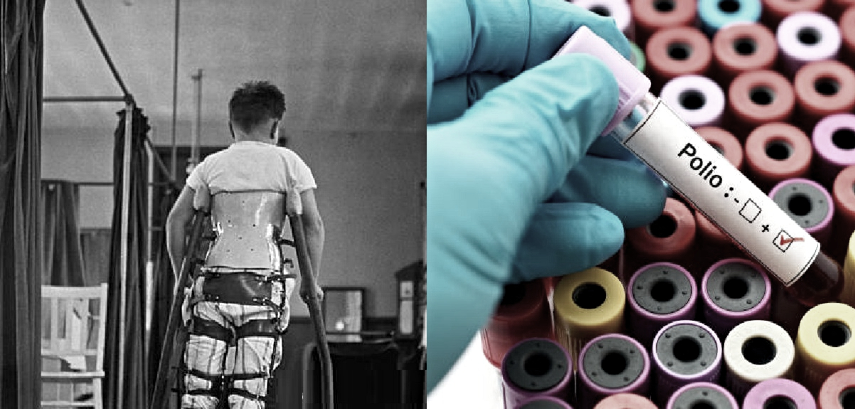 Detectan primer caso de polio en Nueva York: enfermedad estaba erradicada de EE.UU. hace varios años