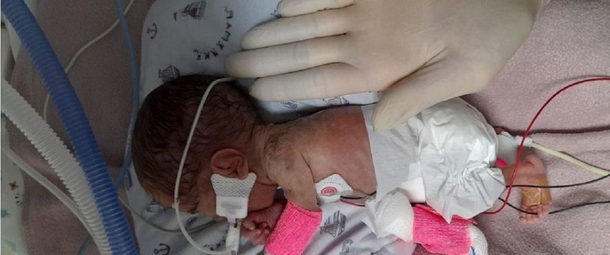 Olivia, bebé más pequeña de América