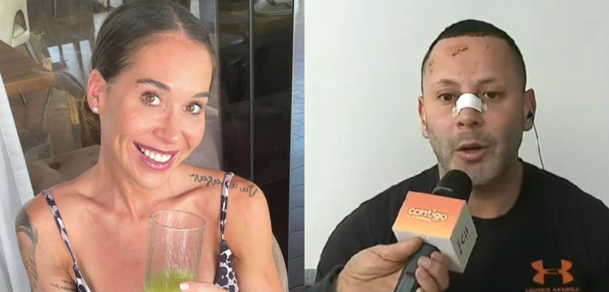 Vale Roth alzó la voz tras brutal golpiza que sufrió coreógrafo de TV: “La gente está muy mala”