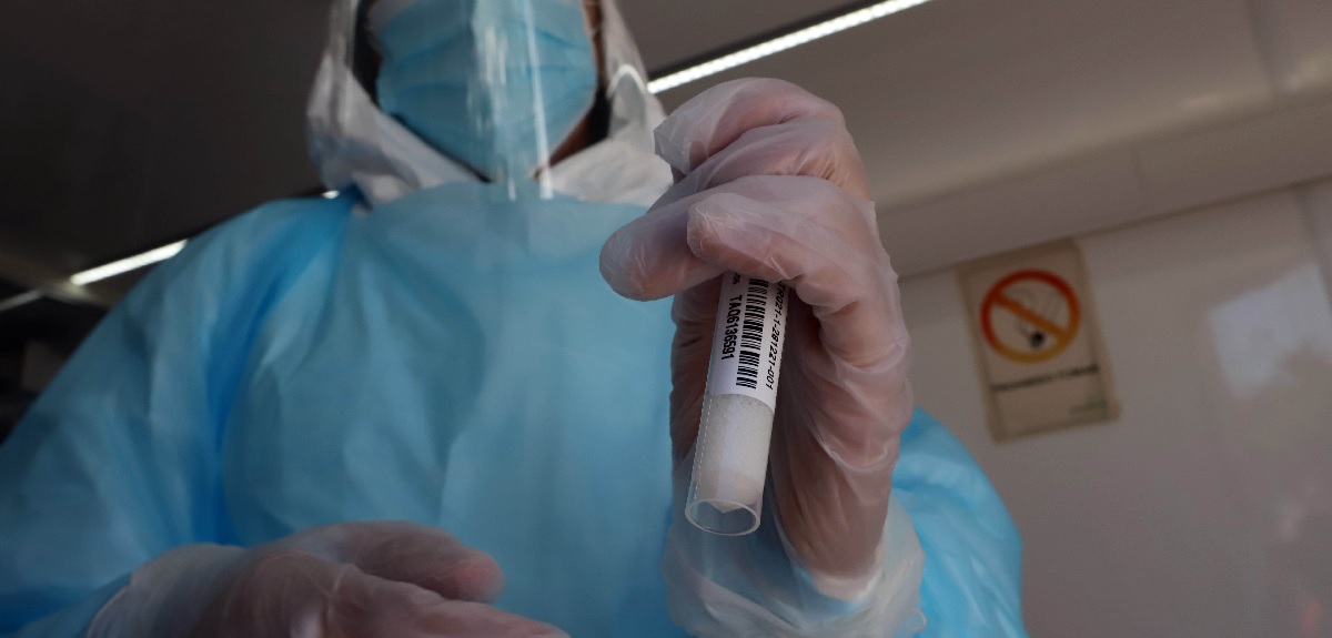 Variante 'Centauro': se registra primer contagio mundial con nueva cepa de COVID-19