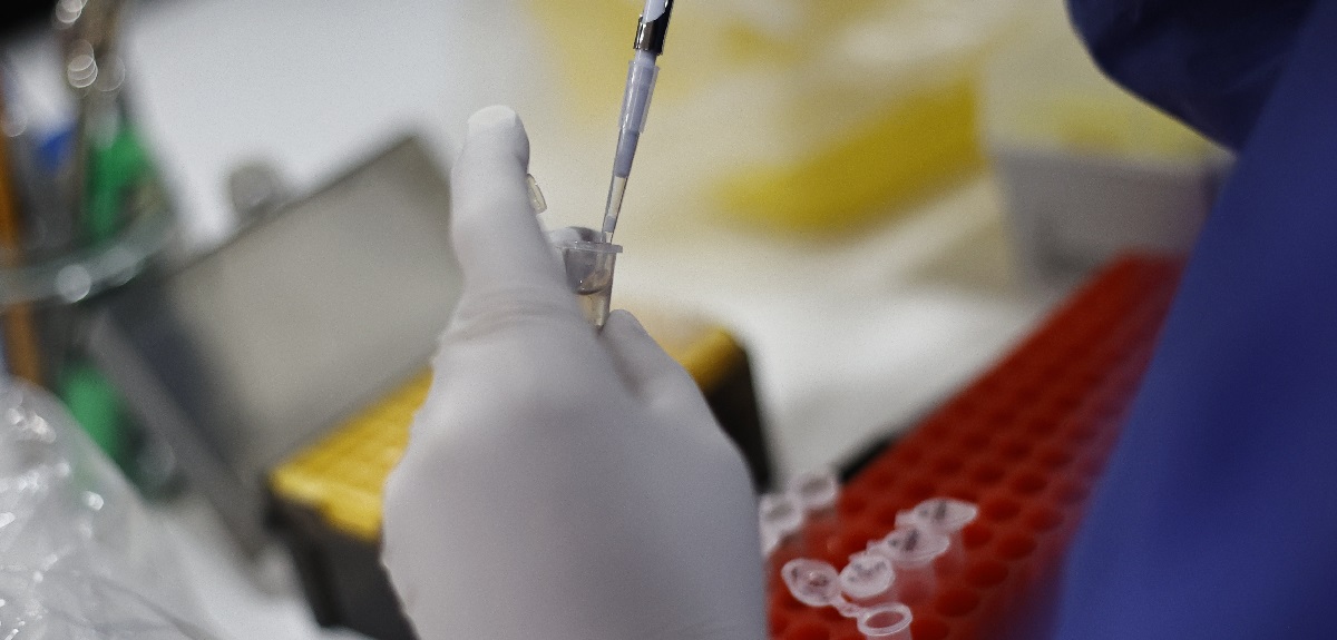 Confirman primer caso de viruela del mono en Antofagasta: van 16 contagiados a nivel nacional