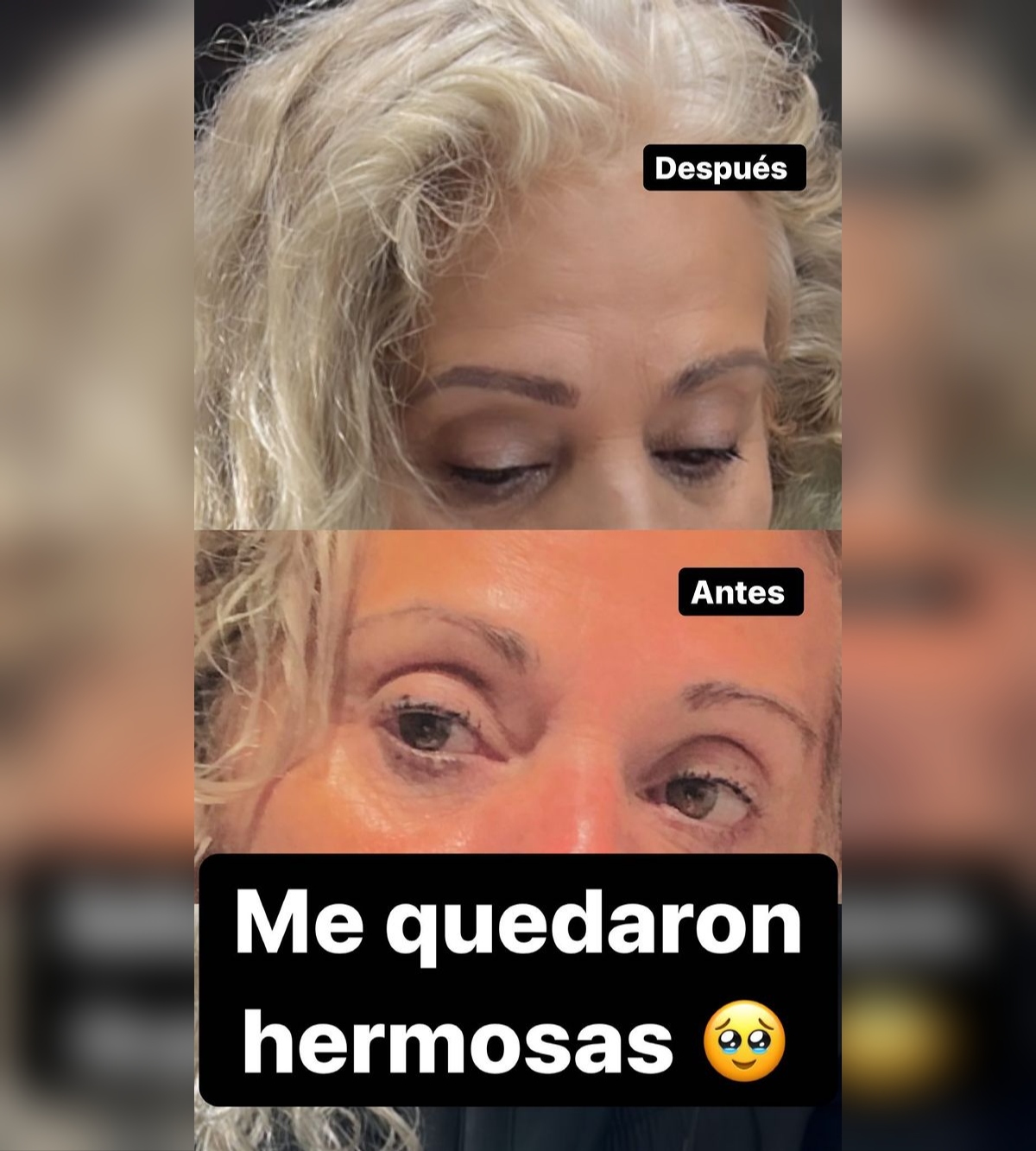 Daniela Aránguiz tratamiento estético