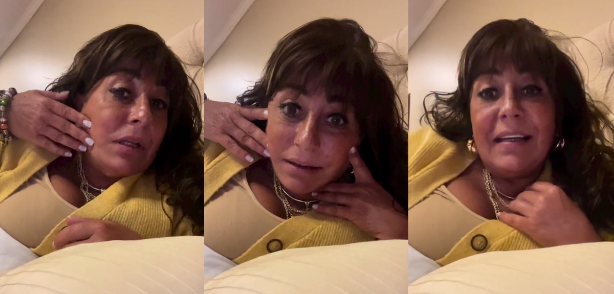 Helhue Sukni contó detalles de su cirugía estética en el rostro: 