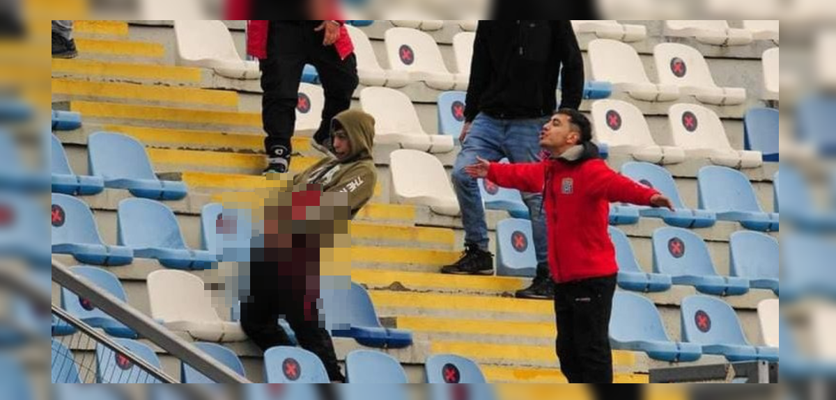 Viralizan ordinario gesto de hincha de Curicó: mostró sus genitales en pleno partido