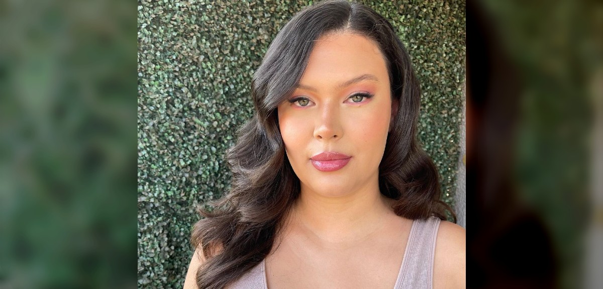 Michelle Carvalho preocupó a sus fans al revelar complejo momento de salud: mostró marcas en su piel