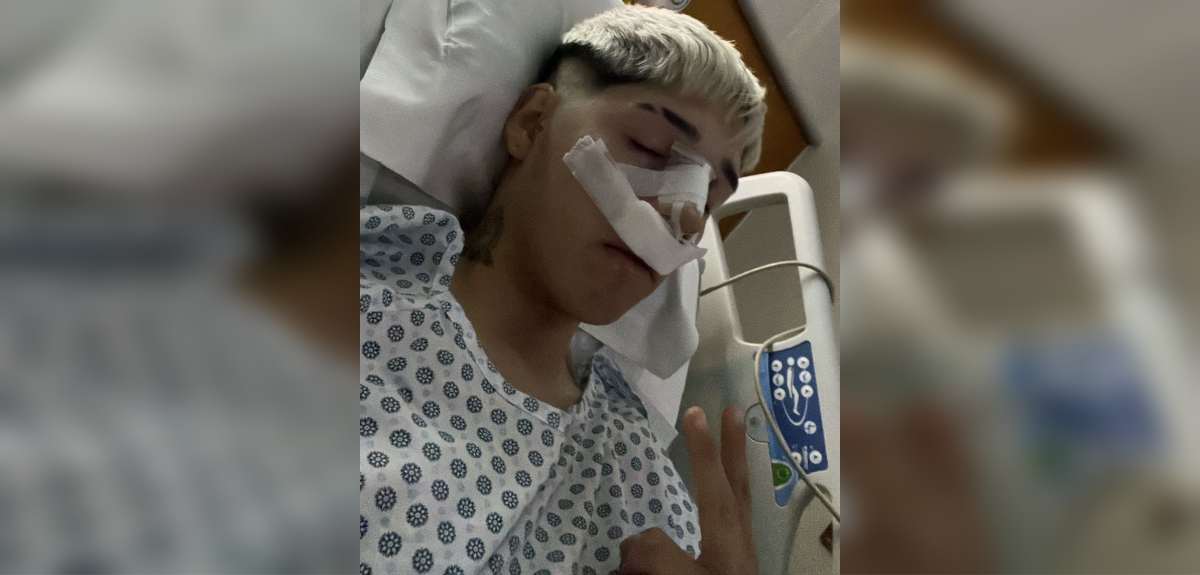 Pailita mostró cómo quedó su nariz tras operación y se refirió a las críticas que recibió