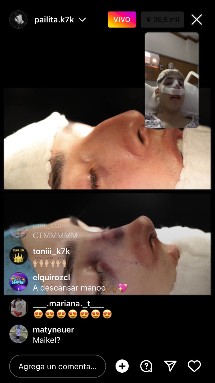 Pailita mostró cómo quedó su nariz tras operación.