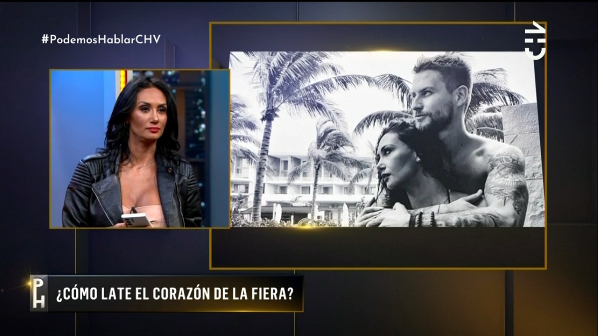 accidente estético Pamela Díaz PH