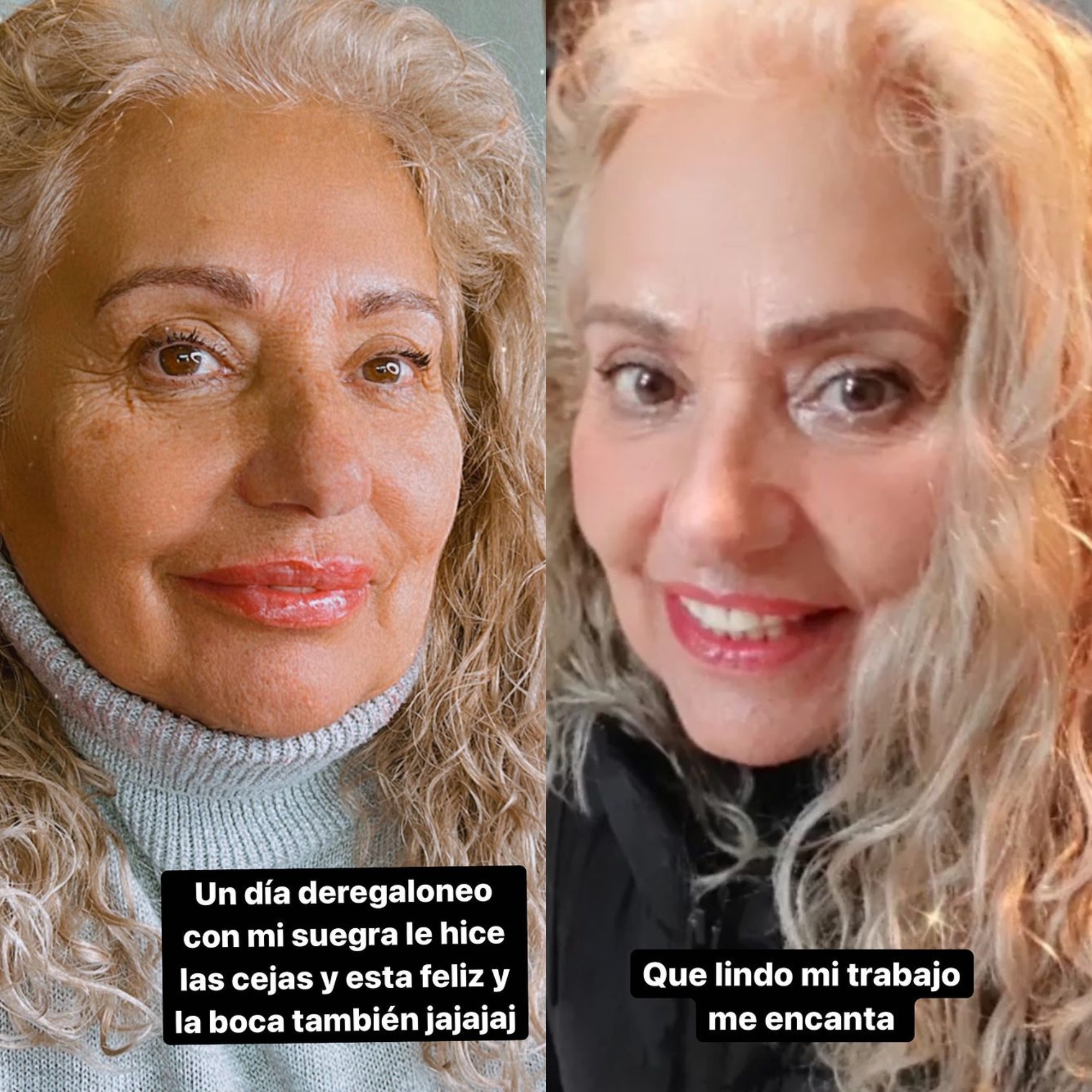 Daniela Aránguiz tratamiento estético