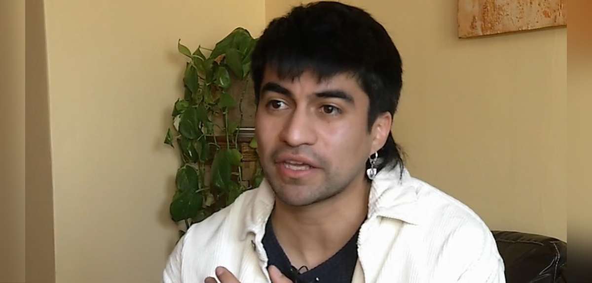 Chileno contagiado con viruela del mono: 