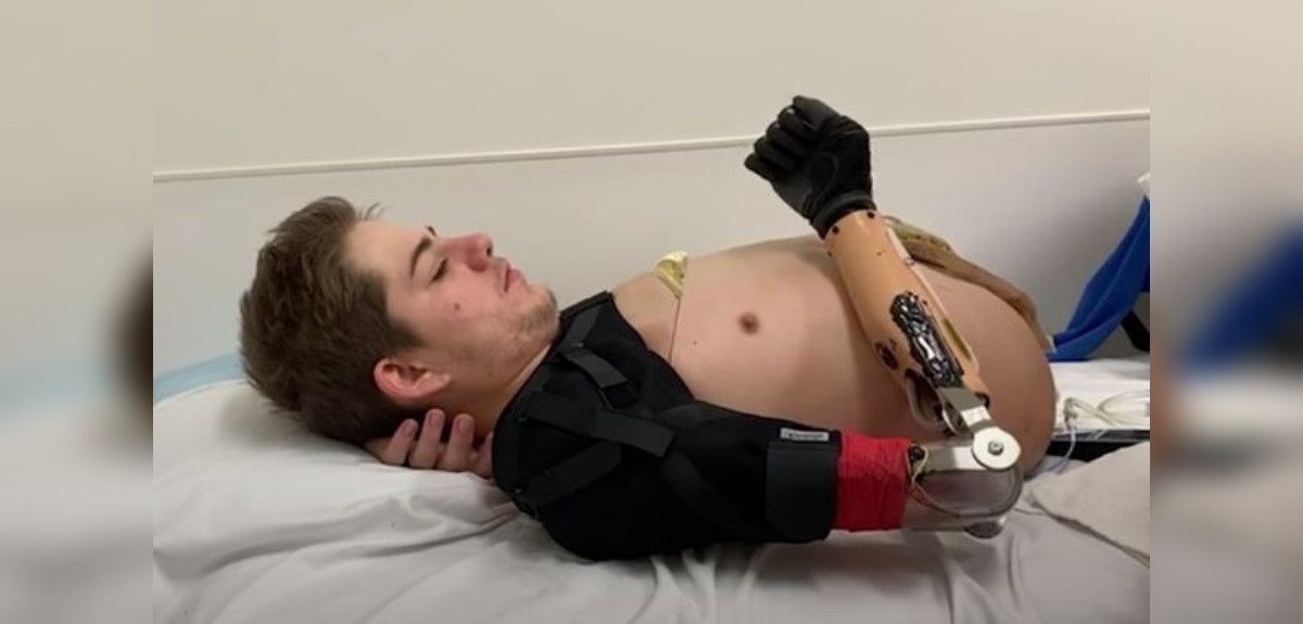 Joven vive sin la mitad de su cuerpo tras accidente con montacargas: sufre 