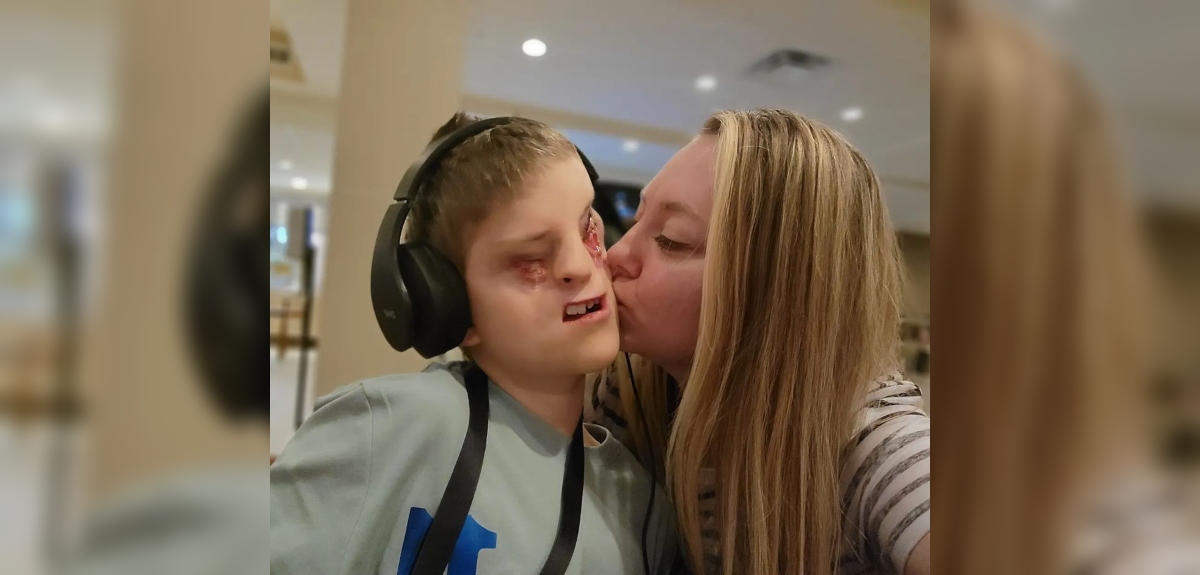 Madre de niño que nació sin ojos enfrenta crueles comentarios en redes: 