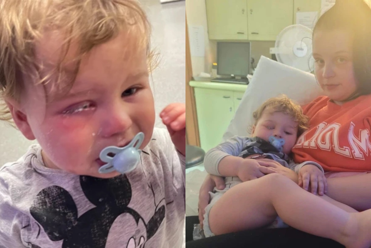 Niño con las pestañas pegadas