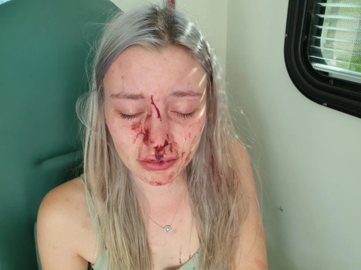 Joven atacó a expareja de su novio tras discusión en redes: usó perfume con forma de zapato stiletto