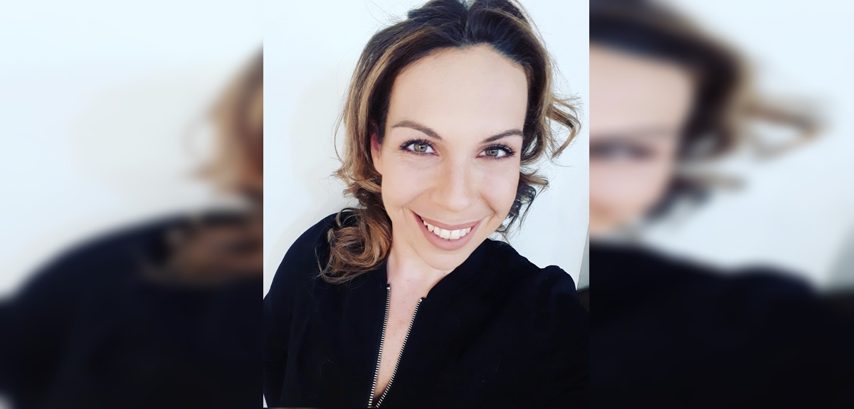 Fran Conserva reveló que se sometió a procedimiento estético: enseñó parte del cambio en su rostro