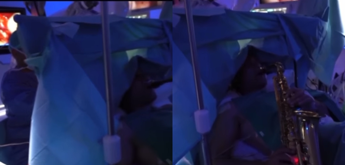 Hombre decidió tocar saxofón mientras cirujanos le extirpaban tumor cerebral en Italia
