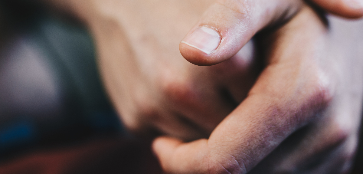 En el Día Mundial de la Psoriasis, conoce los remedios caseros que pueden aliviarla