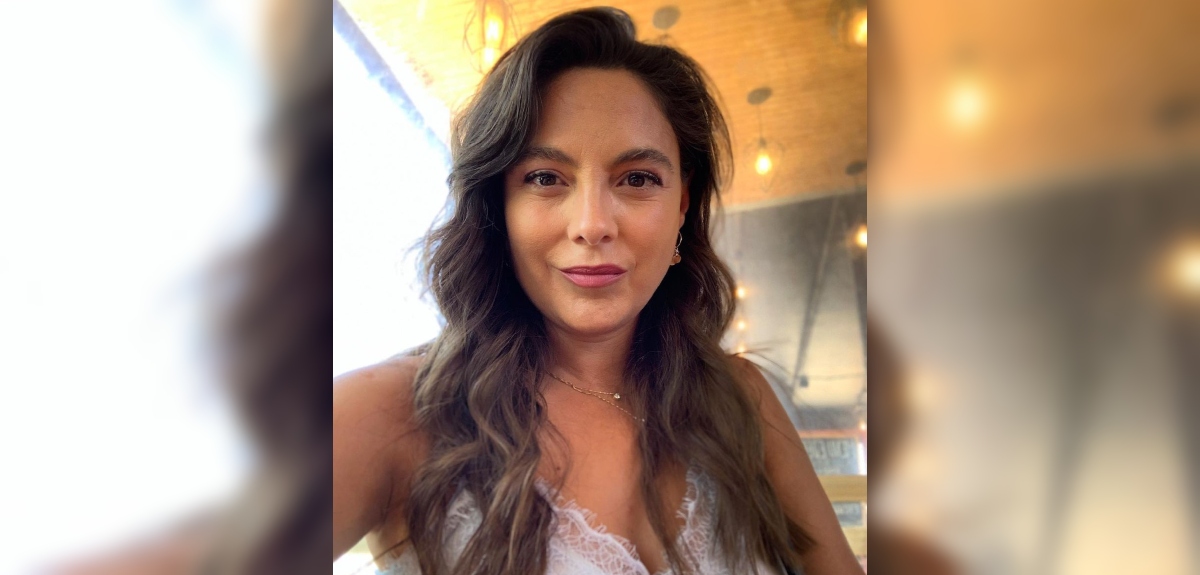 Ángeles Araya detalló cómo fue recuperación de su fractura de clavícula: 