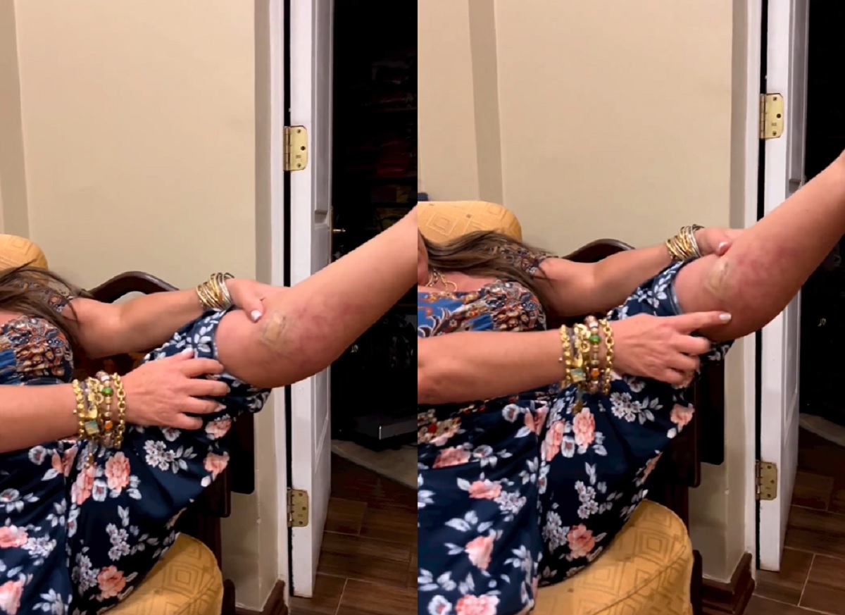 Biopsia de Helhue Sukni