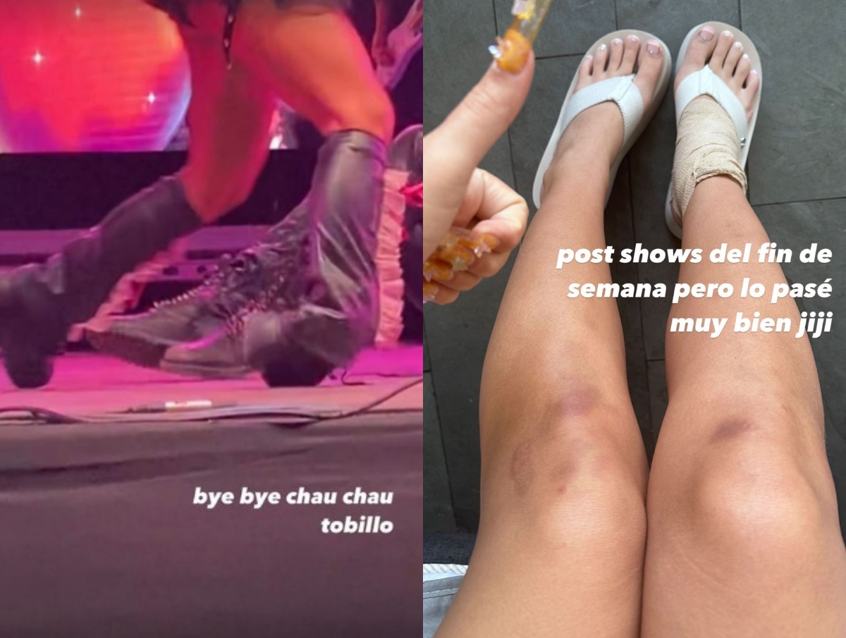 Tobillo de Princesa Alba tras sufrir caída