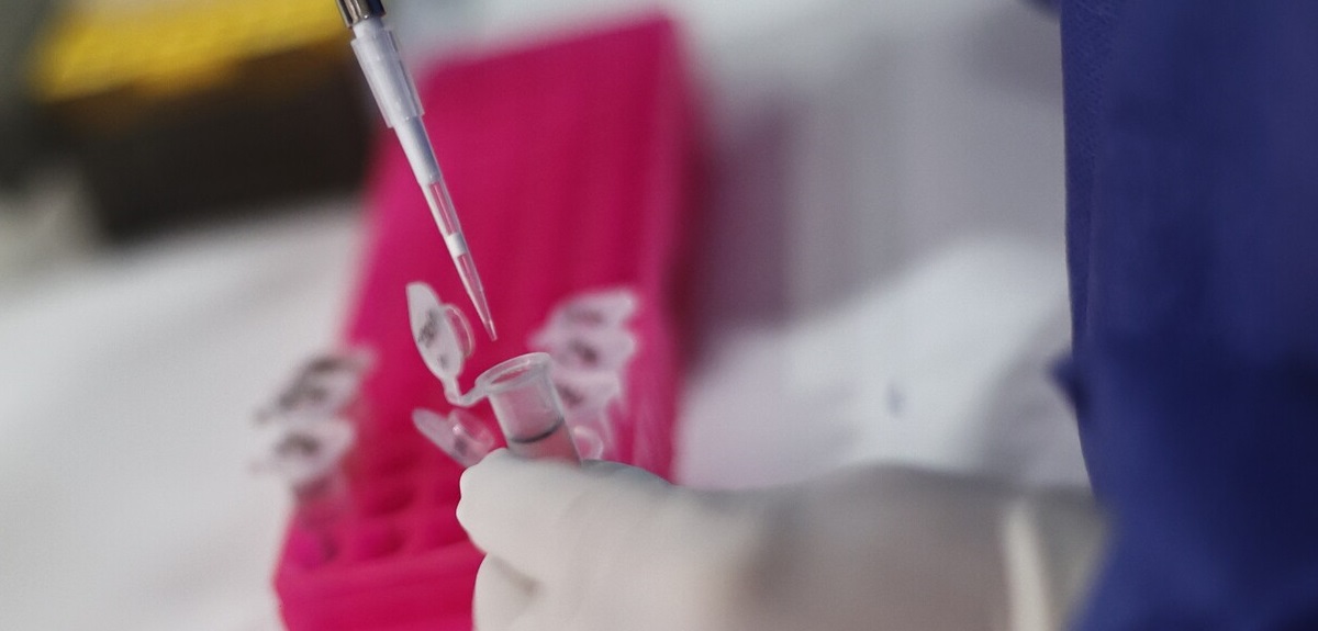 Segundo fallecido por Viruela del Mono en Chile: Minsal entregó medidas preventivas