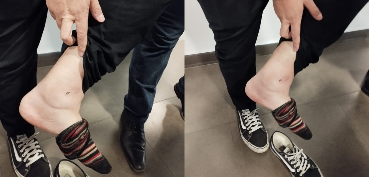 Rodrigo Gallina habló de su lesión y por qué decidió participar igual de la Teletón: "Me duele"