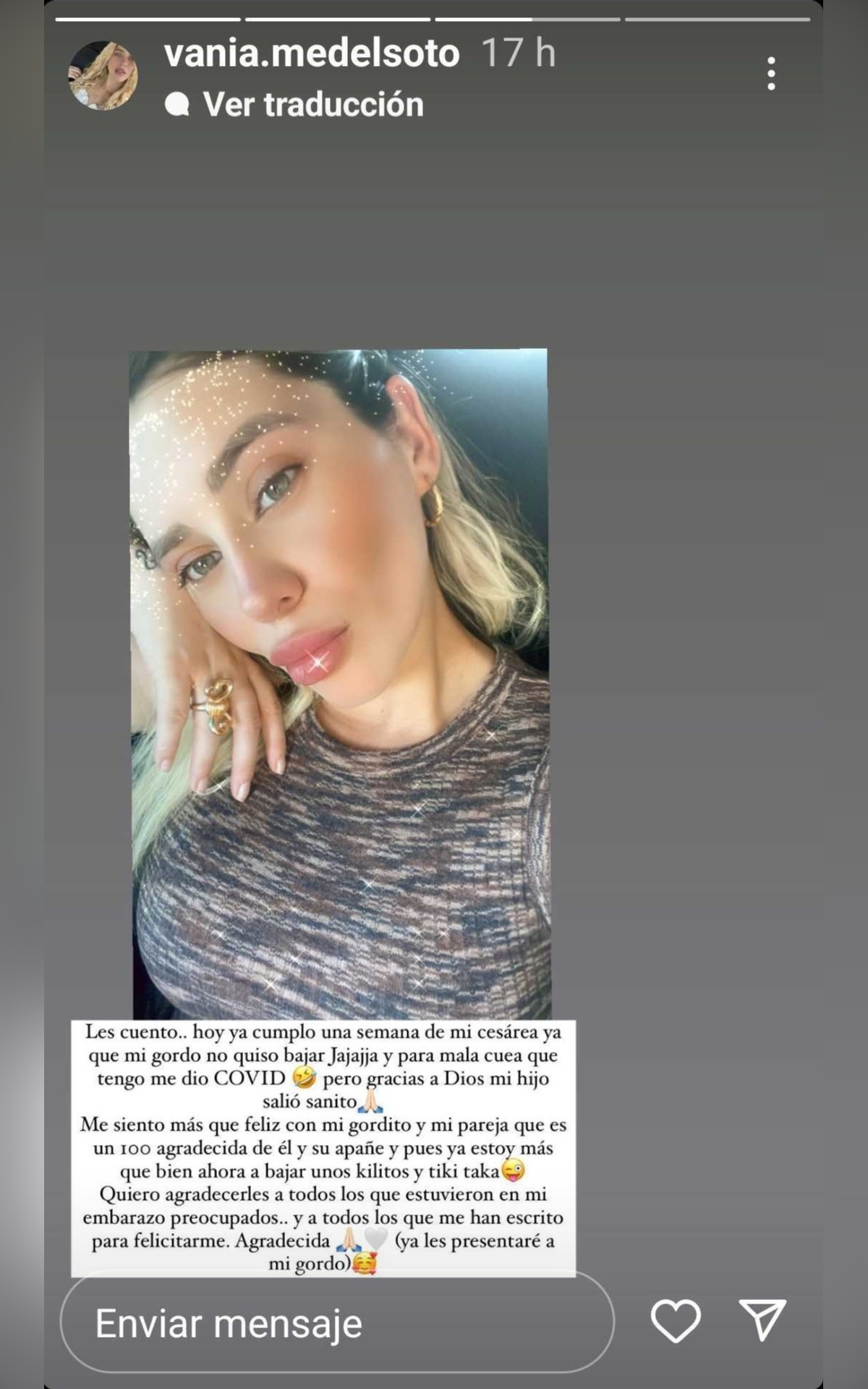 Hermana de Gary Medel, Pitbull, fue madre