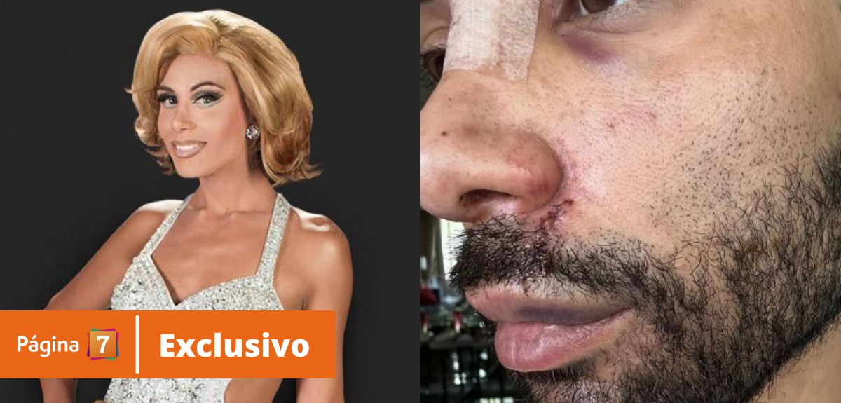 'Luz Violeta' denunció brutal agresión por parte de exparticipante de The Switch: 