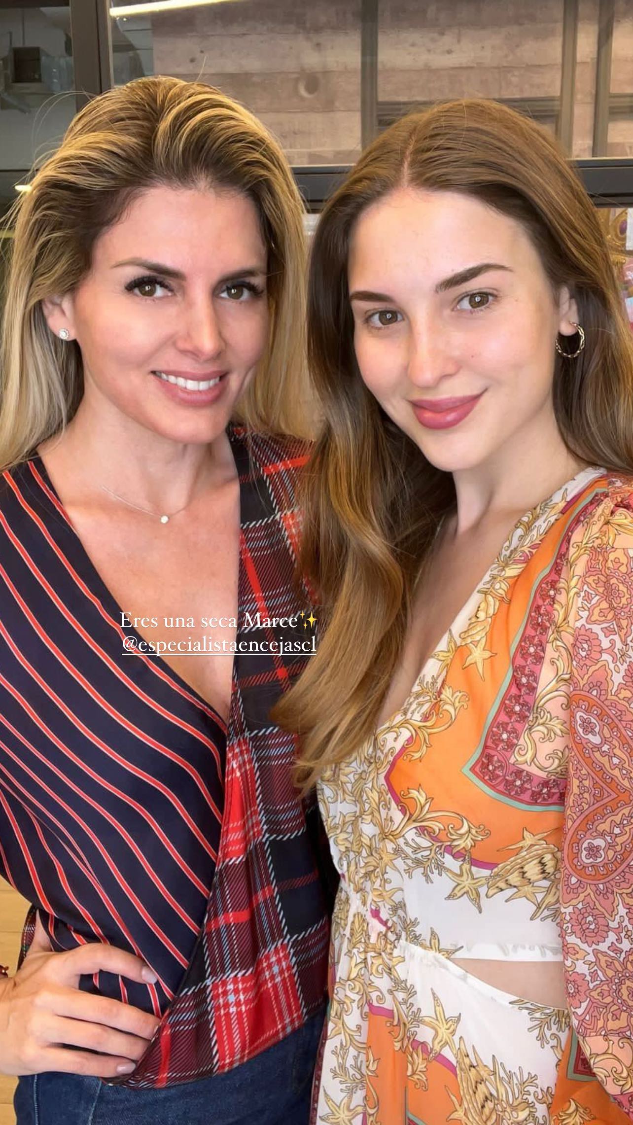 Belén Soto reveló que se sometió a tratamiento estético en su rostro