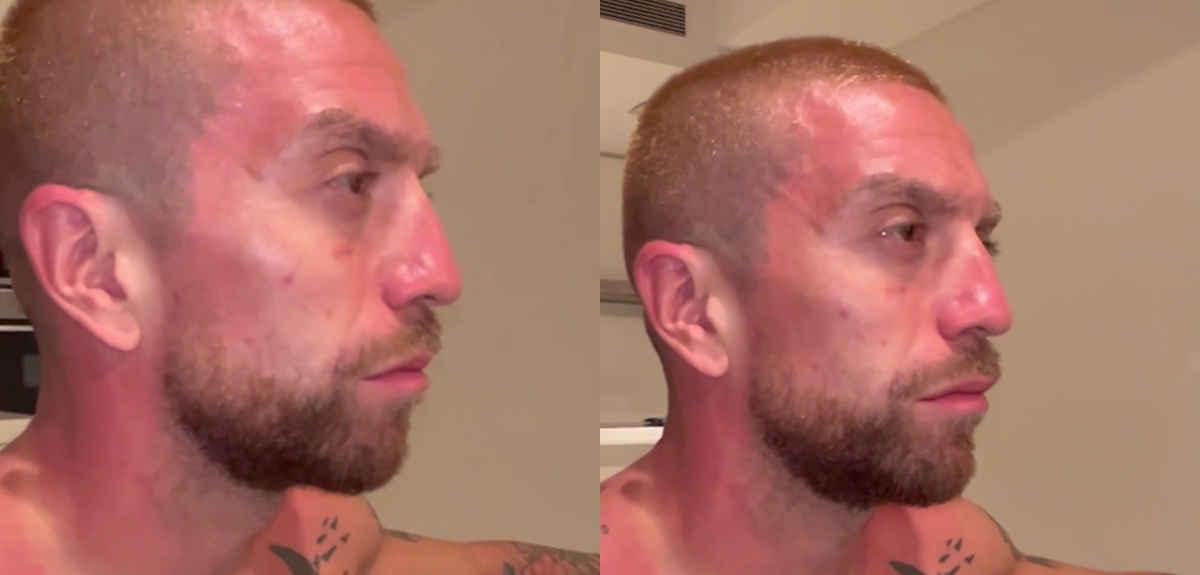 'Papu' Gómez mostró las secuelas que le quedaron tras caravana en Buenos Aires: “Necesito aloe vera”