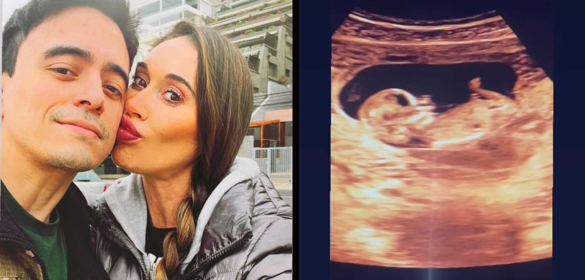 Pareja de Vale Roth, Miguel de la Fuente, sobre su embarazo: 