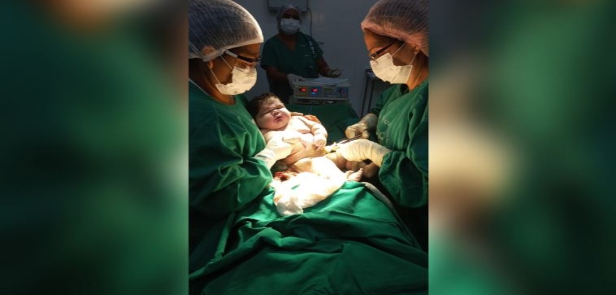 Bebé nació de 7 kilos y rompió récord en Brasil: su madre quedó en shock