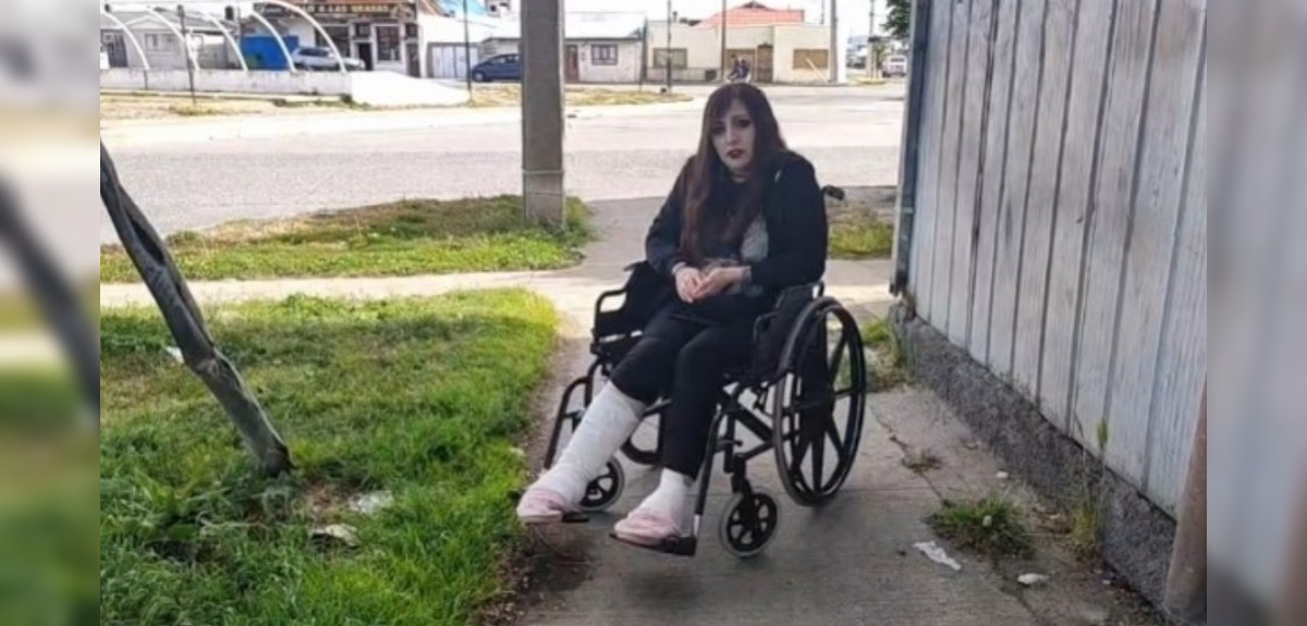 Mujer acusa grave negligencia médica en Punta Arenas: le operaron la pierna equivocada