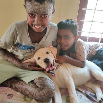 Niño de 12 años padece extraña enfermedad que le produce "piel de serpiente"