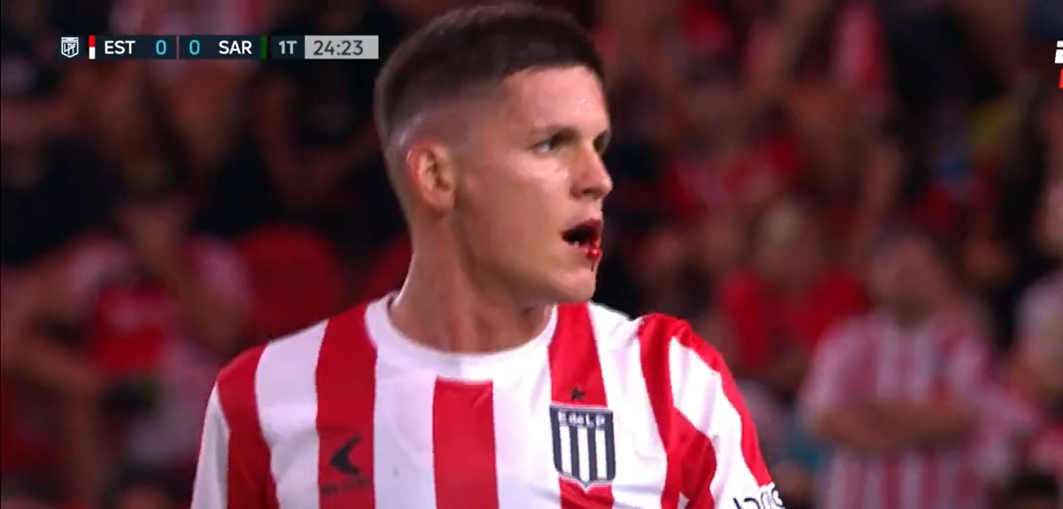 ¡Golpe del terror! Exfutbolista de Colo Colo le 