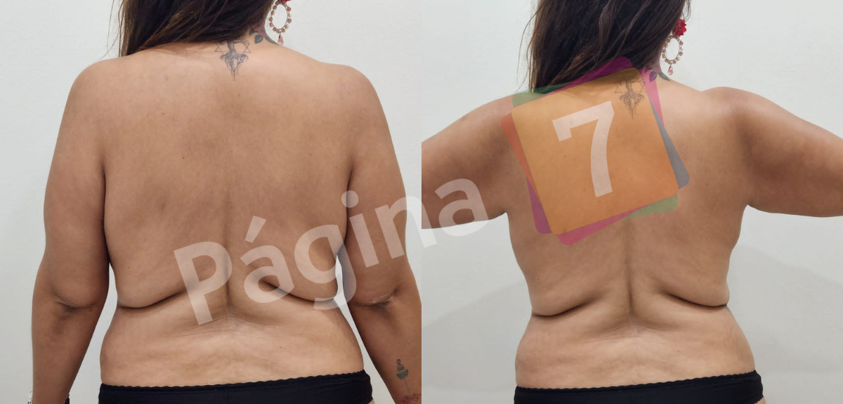 Pamela Leiva se sometió a tratamiento estético a días de Viña 2023: "Es escandalosa la diferencia"