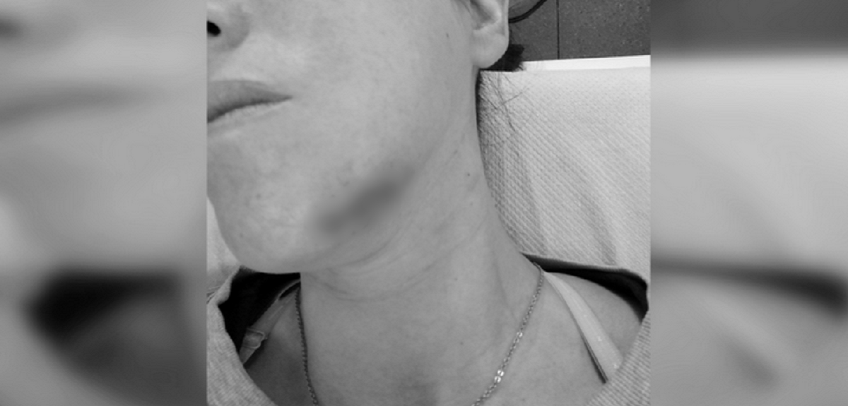 Mujer quedó 'en shock' tras ser apuñalada en la cara por una adolescente en el Metro