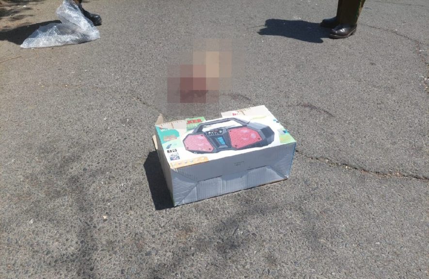 brazo amputado vía pública calle Recoleta