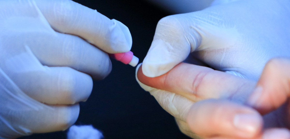 Positividad de 1,3% y no 30%: Seremi de Salud rectifica cifras de operativo de test VIH en la RM