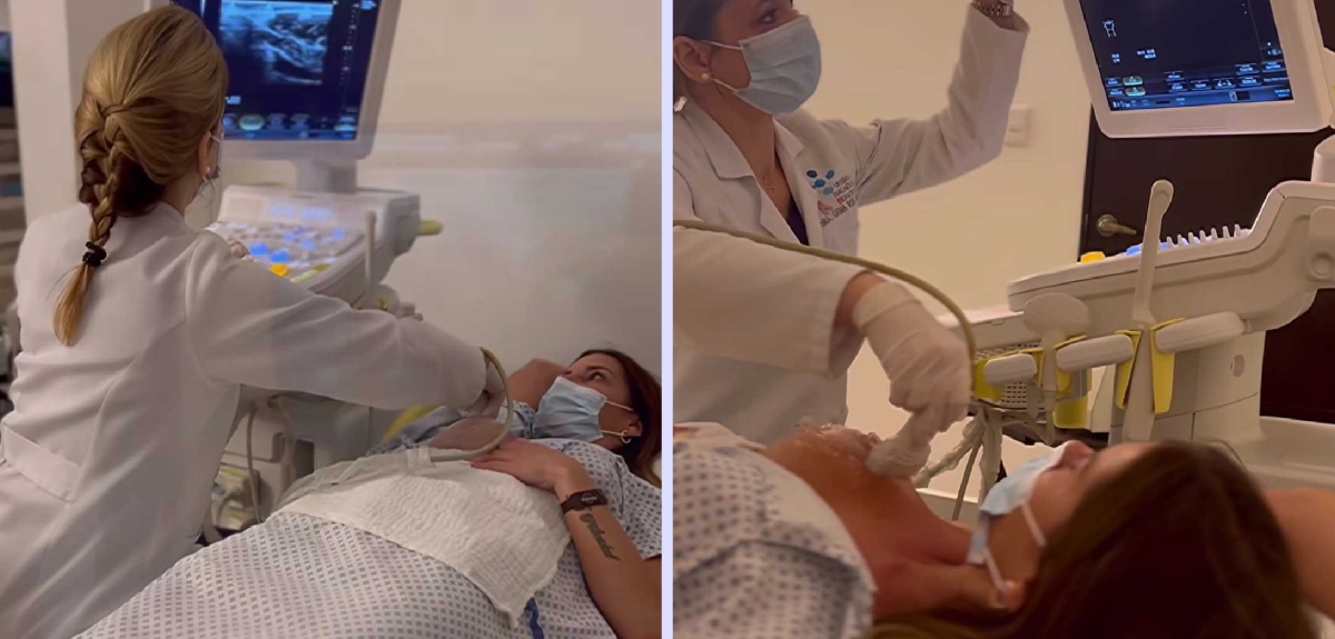 Gala Caldirola se realizó exámenes por nódulo sospechoso en su pecho: 